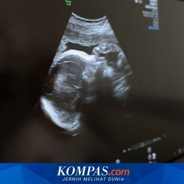 AI Bantu Tenaga Kesehatan Skrining Ibu Hamil Saat Dokter Spesialis Minim AI Bantu Tenaga Kesehatan Skrining Ibu Hamil Saat Dokter Spesialis Minim