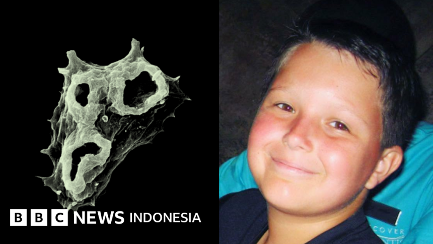 Ameba Pemakan Otak: Ancaman Global yang Kian Meluas Ameba Pemakan Otak: Ancaman Global yang Kian Meluas