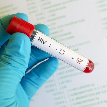 Kemenkes RI Tegaskan Lonjakan Kasus HIV di Sidoarjo Bukan Akibat Penularan Meningkat