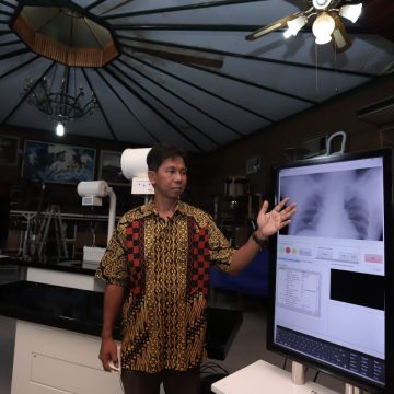 Dukung Eliminasi Tuberkulosis, Dosen UGM Luncurkan Rumah Skrining dan Radiografi Keliling