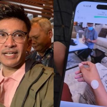 Ruben Onsu Akhirnya Mau Tes Kesehatan Setelah Awalnya Menolak, Ini Bukti Medis yang Dibongkar