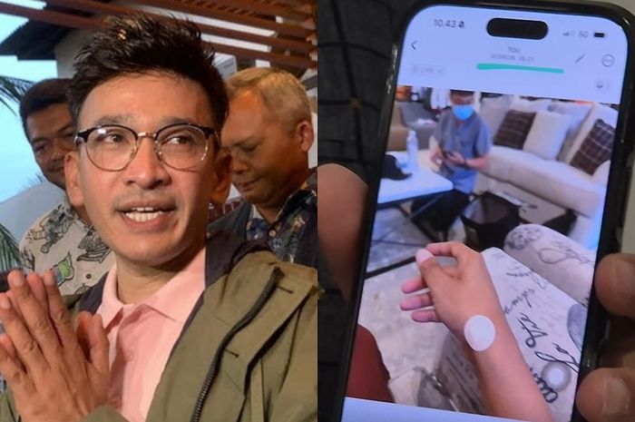 Ruben Onsu Akhirnya Mau Tes Kesehatan Setelah Awalnya Menolak, Ini Bukti Medis yang Dibongkar Ruben Onsu Akhirnya Mau Tes Kesehatan Setelah Awalnya Menolak, Ini Bukti Medis yang Dibongkar